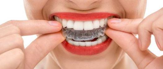 Bruksizm Tedavisi Nedir?, Vanda Özel Diş Hekimi Açıklamaları