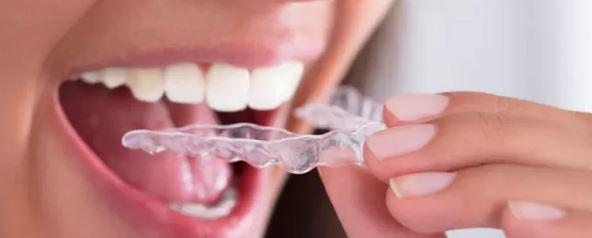 Bruksizm Tedavisi Nedir?, Vanda Özel Diş Hekimi Açıklamaları