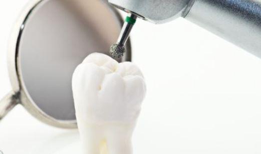 Van da Diş Kliniği Hizmetlerinde Son Gelişmeler