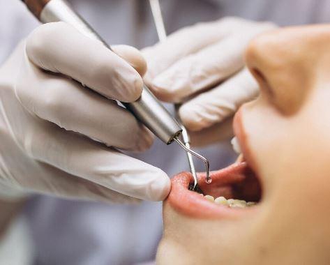 Van Diş Hekimi Uzman Diş Doktorlarıyla Kaliteli Ağız Sağlığı Hizmetleri